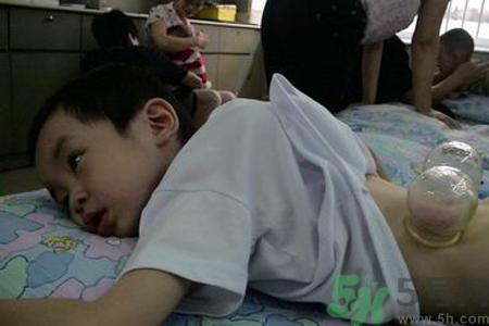 小孩可以拔罐嗎？寶寶能拔火罐嗎？