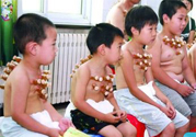 小孩可以拔罐嗎？寶寶能拔火罐嗎？