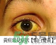 上腹部不舒服有時疼痛會不會是胰臟癌？
