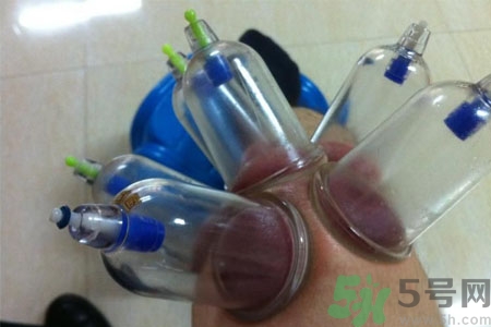 膝蓋能拔罐嗎？膝蓋疼可以拔罐嗎？