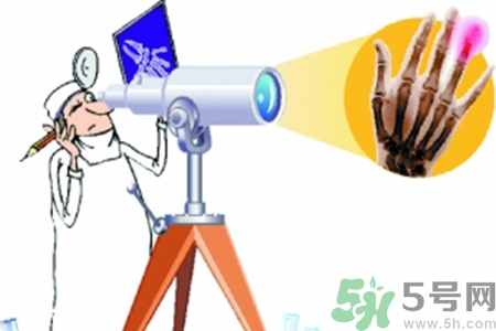 什么年齡測(cè)骨齡最好？如何測(cè)骨齡？