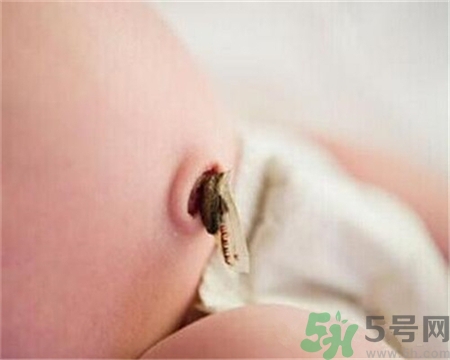 新生兒肚臍怎么護(hù)理？新生兒肚臍什么時候掉？