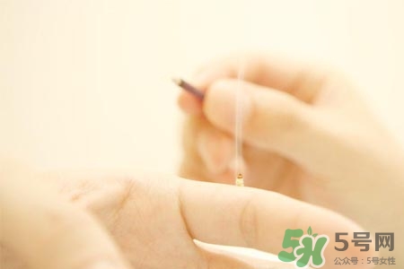 面癱能艾灸嗎？艾灸能治療面癱嗎？