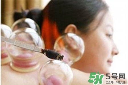 拔罐放血對身體好嗎？拔罐放血有什么好處？