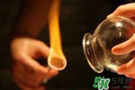 拔罐放血對身體好嗎？拔罐放血有什么好處？