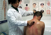 刮痧后什么顏色才健康？刮痧顏色反映的病癥