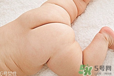 擴(kuò)肛有什么好處？擴(kuò)肛需要注意什么？