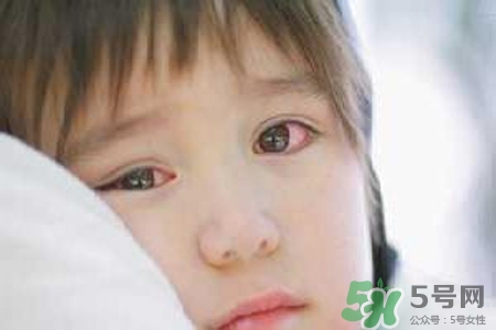 孩子為什么老眨眼睛？孩子總眨眼睛怎么回事？
