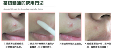 the body shop茶樹精油怎么用？美體小鋪茶樹精油怎么打開