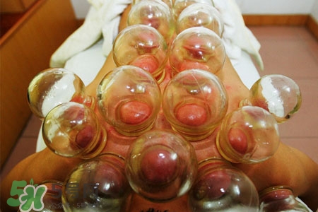 拔罐后皮膚發(fā)癢是怎么回事？拔罐后為什么皮膚會癢？