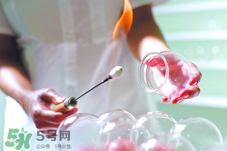冬天拔罐后多久能洗澡？警惕冬季拔罐后不宜立即洗澡