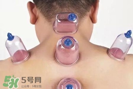 拔罐后可以喝酒嗎？拔罐后多久能喝酒？