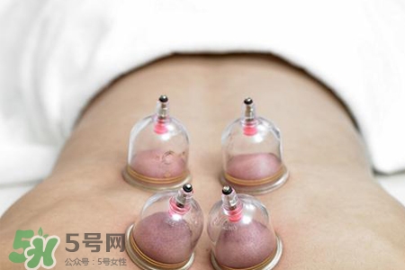 拔罐后可以泡澡嗎？拔罐后多久能泡澡？