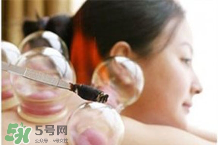 冬天拔火罐能減肥嗎？拔火罐什么季節(jié)減肥效果最好？