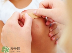 創(chuàng)可貼多久換一次?創(chuàng)可貼多長時(shí)間換一次?