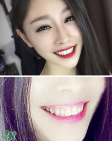 碧緹福冷光牙齒美白儀怎么用？碧緹福冷光牙齒美白儀使用方法