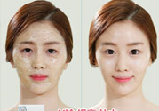 skin1004是什么牌子？skin1004屬于什么檔次