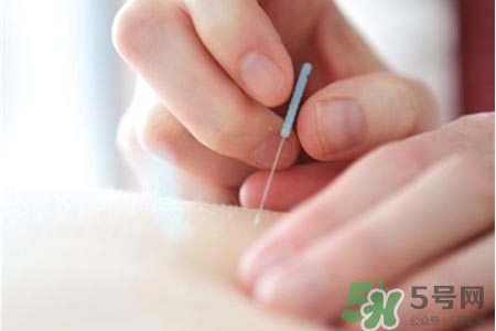 腰間盤突出可以針灸嗎？針灸能治腰間盤突出嗎？