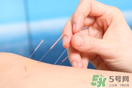 腰間盤突出可以針灸嗎？針灸能治腰間盤突出嗎？