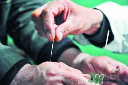 腰間盤突出可以針灸嗎？針灸能治腰間盤突出嗎？