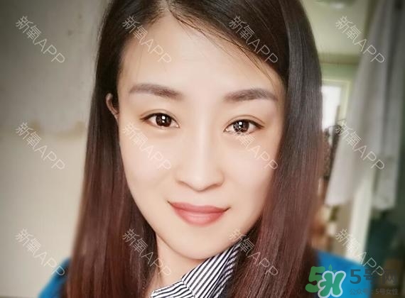 埋線雙眼皮能保持多久？埋線雙眼皮是永久嗎