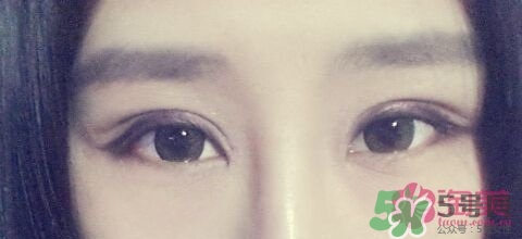 切開雙眼皮多久消腫？切開雙眼皮多久恢復(fù)？
