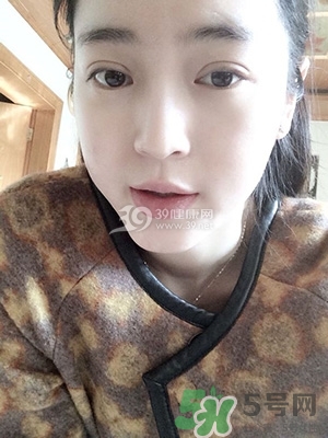 什么是定點雙眼皮？定點雙眼皮多少錢？