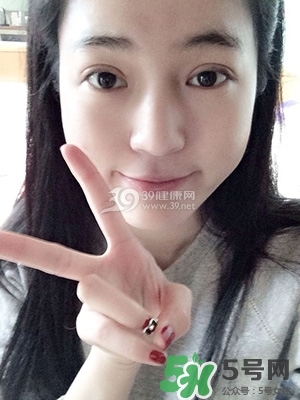 什么是定點雙眼皮？定點雙眼皮多少錢？