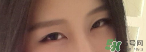 切開雙眼皮多久消腫？切開雙眼皮多久恢復(fù)？