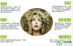 N7發(fā)膜多少錢一盒？N7發(fā)膜價(jià)格