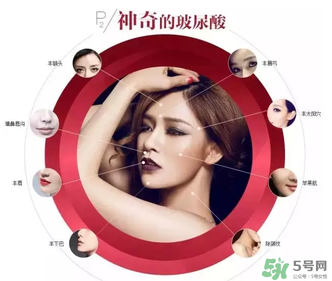 喬雅登是哪個(gè)國家的？喬雅登玻尿酸哪個(gè)國家？
