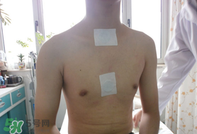 三九貼怎么貼？三九貼的貼法
