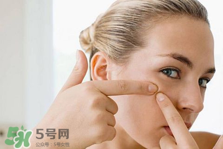 膠原蛋白能祛除痘印嗎？膠原蛋白可以去痘坑嗎？
