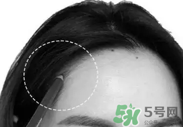 發(fā)際線高適合什么發(fā)型？發(fā)際線高怎么辦