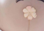 妊娠線每個孕婦都有嗎？妊娠線出現(xiàn)的時間