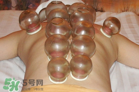 冬天可以拔罐放血嗎？冬天拔罐放血好嗎？