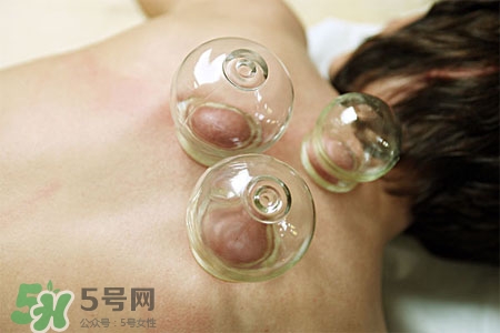 拔罐放血會得傳染病么？拔罐放血會傳染疾病嗎？