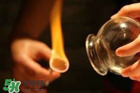 拔罐放血能治皮膚病嗎？拔罐放血能治牛皮癬嗎？
