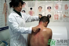 刮痧可以去濕氣嗎？體內(nèi)濕氣重刮痧有用嗎？