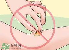 水泡怎么處理？水泡要不要刺破？