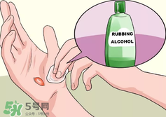 水泡怎么處理？水泡要不要刺破？