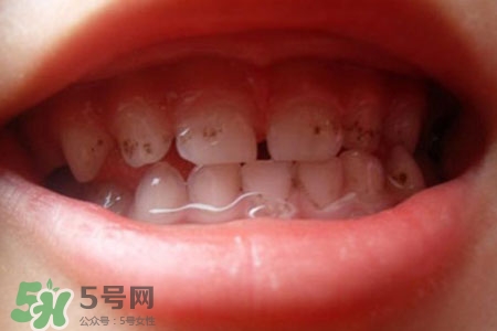 刷牙后吃東西發(fā)苦正常嗎？為什么刷牙后吃東西發(fā)苦？