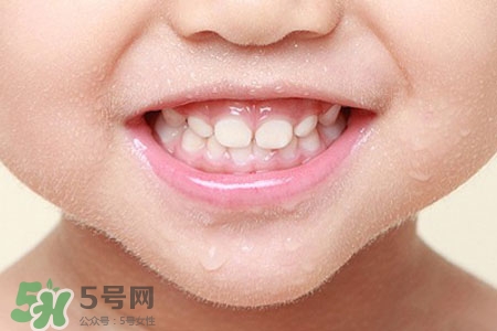 刷牙后吃東西發(fā)苦正常嗎？為什么刷牙后吃東西發(fā)苦？