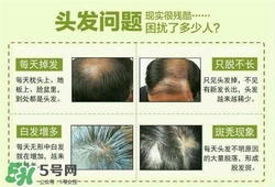 牛角梳梳頭可以生發(fā)嗎？牛角梳怎么梳頭？