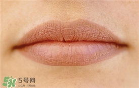 卡唇紋是什么意思？卡唇紋怎么辦？