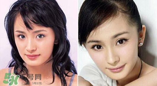打瘦臉針能懷孕嗎？打瘦臉針能吃避孕藥嗎？