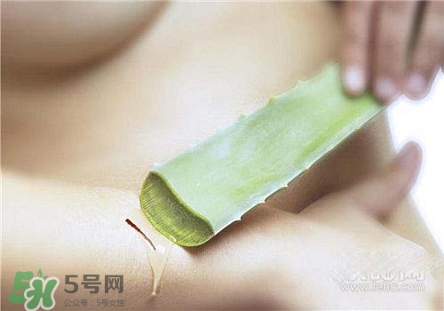 蘆薈涂在臉上發(fā)癢是怎么回事？蘆薈涂在臉上發(fā)癢怎么辦？