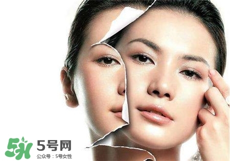 美白針是什么？美白針可以連續(xù)打嗎？