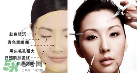 美白針的效果明顯嗎？美白針一個療程幾次？