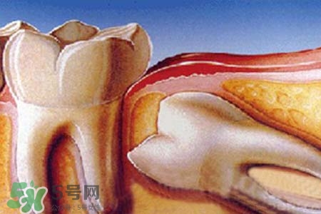 智齒經常發(fā)炎怎么辦？智齒反復發(fā)炎腫痛怎么辦？